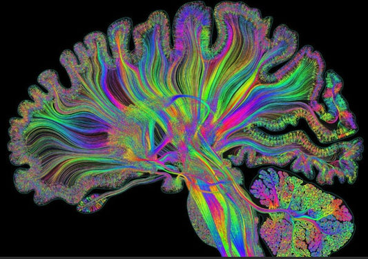 Como a Neuroestética Está Transformando a Arte Contemporânea